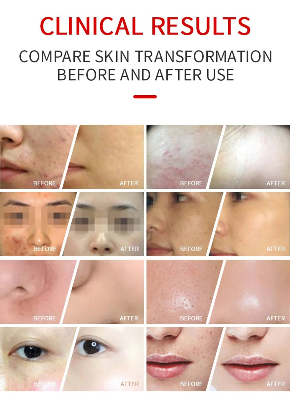 Before and after skincare results showing clearer, smoother facial skin transformation.
